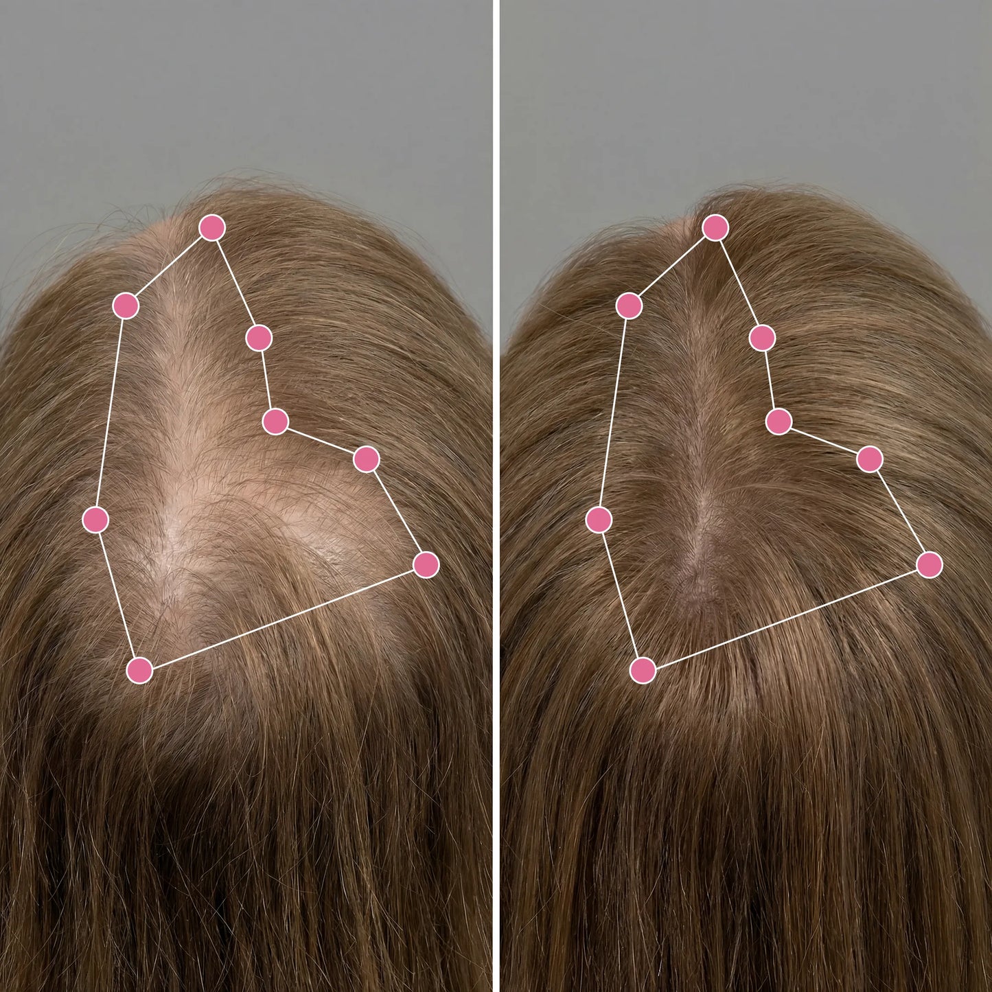 Hair Helper Spray - Korean Scalp Ritual