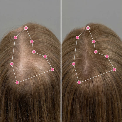Hair Helper Spray - Korean Scalp Ritual