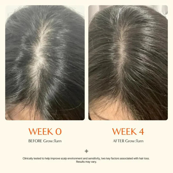 FolìGrow - Hair Growth Serum Brush