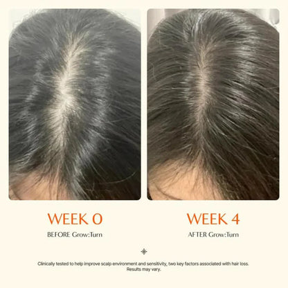 FolìGrow - Hair Growth Serum Brush