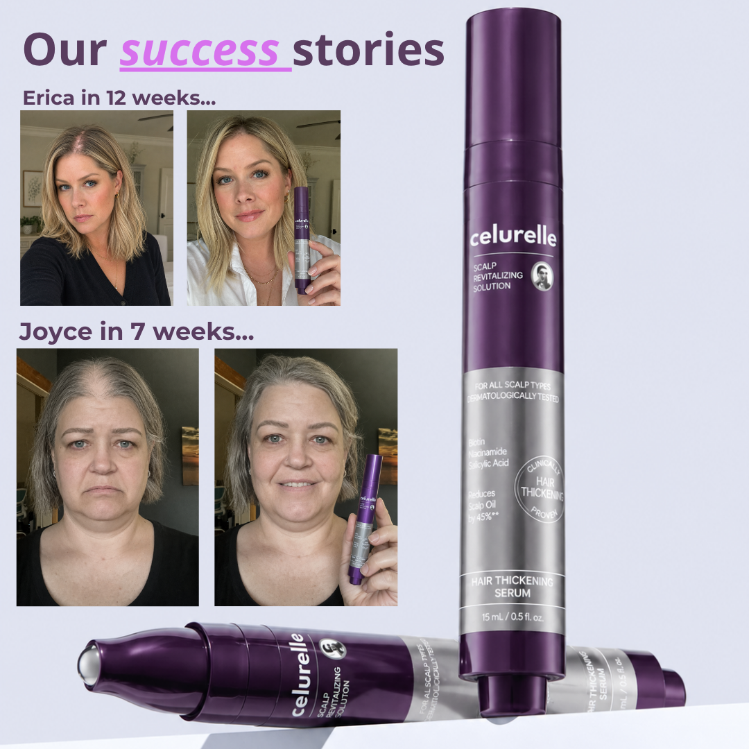 VitaRoot™ Scalp Revitalizing Serum