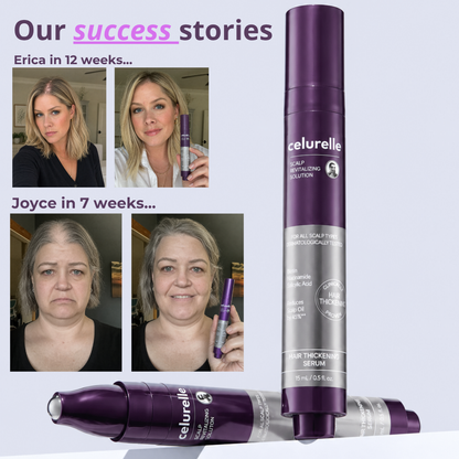 VitaRoot™ Scalp Revitalizing Serum
